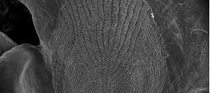 A typical array of the growth rings of the brill fish, Scophthalmus rhombus